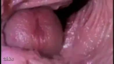 Камера внутри вагины показывает извержение спермы